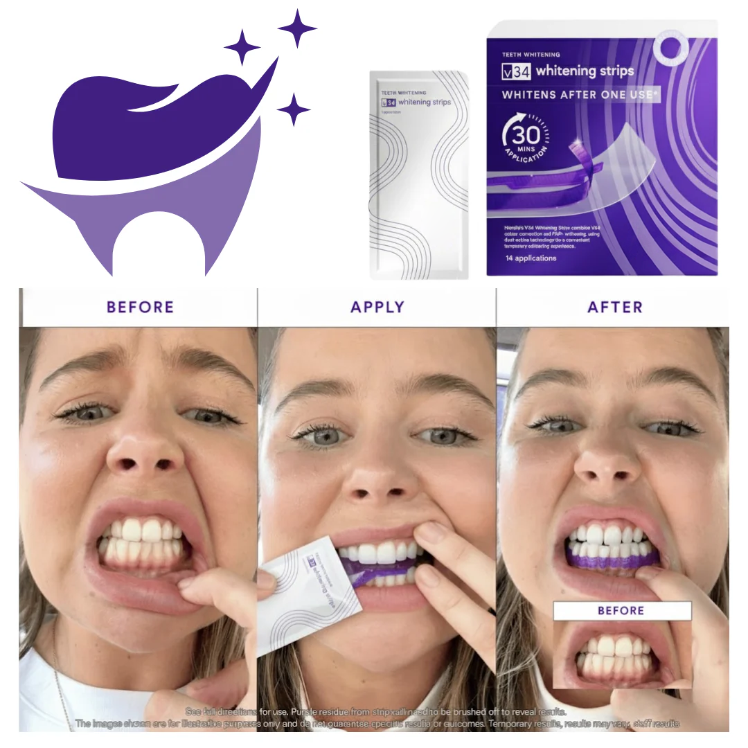 SmileV34™Whitening Strips: ‘’The Fast Track to a Stunning Smile! 42 in a box