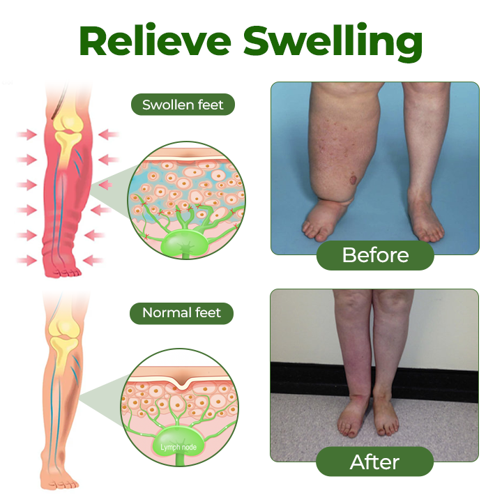 Timilk® Professional Leg Circulation Cream – Soothes Tired, Achy Legs, Relieves Muscle Tension & Supports Everyday Leg Comfort