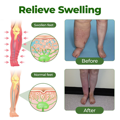 Timilk® Professional Leg Circulation Cream – Soothes Tired, Achy Legs, Relieves Muscle Tension & Supports Everyday Leg Comfort