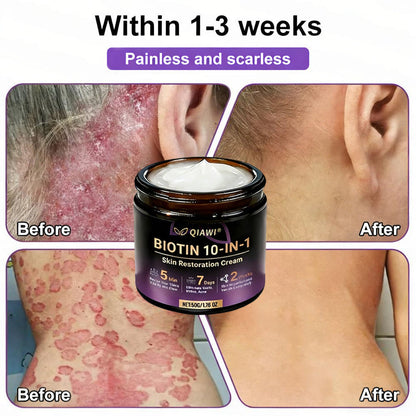 Made and Shipped from USA 🍁 QIAWI® Biotin 10-in-1 Skin Restoration Cream – Last Day Promotion: 75% OFF