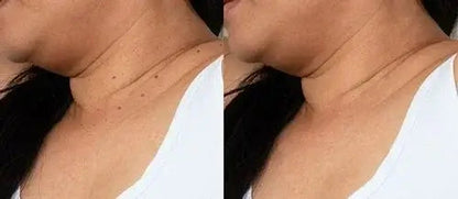 Clinically proven to remove 95% of moles, warts, and skin imperfections - permanently in just 3 days!