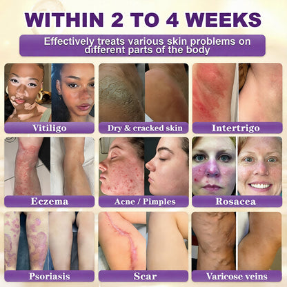 Made and Shipped from USA 🍁 QIAWI® Biotin 10-in-1 Skin Restoration Cream – Last Day Promotion: 75% OFF