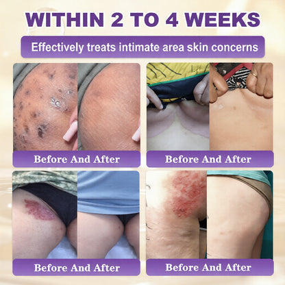 Made and Shipped from USA 🍁 QIAWI® Biotin 10-in-1 Skin Restoration Cream – Last Day Promotion: 75% OFF