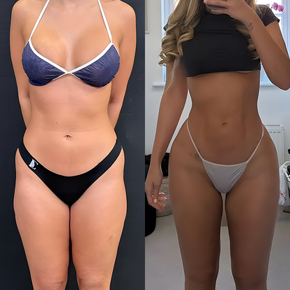 Micro-Needle Firming Patches: Reverse the Flattening Caused by Sitting For Visibly Firmer, Lifted Curves In 4 Weeks, No Surgery