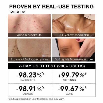 TEASHELL NIACINAMIDE BRIGHTENING SOAP TRANEXAMIC ACID 100G