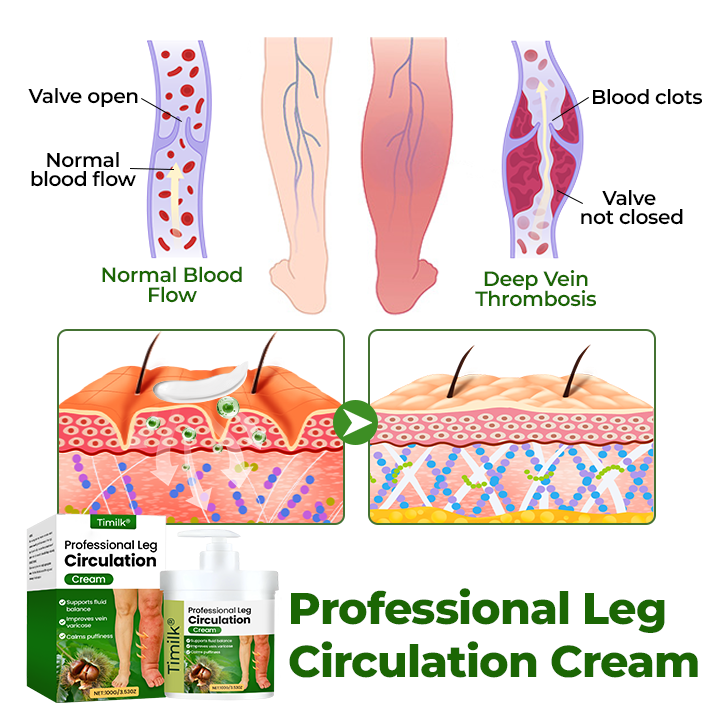 Timilk® Professional Leg Circulation Cream – Soothes Tired, Achy Legs, Relieves Muscle Tension & Supports Everyday Leg Comfort
