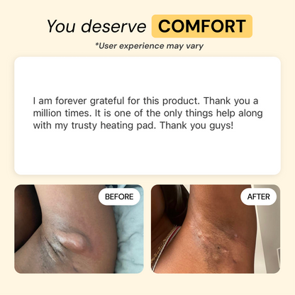 Universal Flare Care Calmer Skin in 7 Days for Boils, HS, Cysts & Painful Flare-Ups