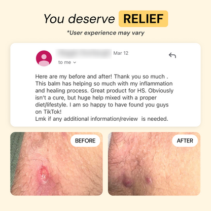 Universal Flare Care Calmer Skin in 7 Days for Boils, HS, Cysts & Painful Flare-Ups