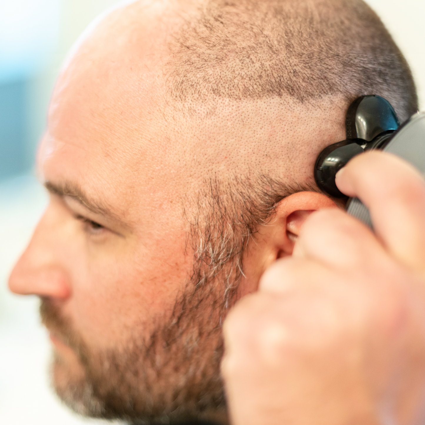 The Electric Scalp Shaver Made for Fast, Easy Head Shaves