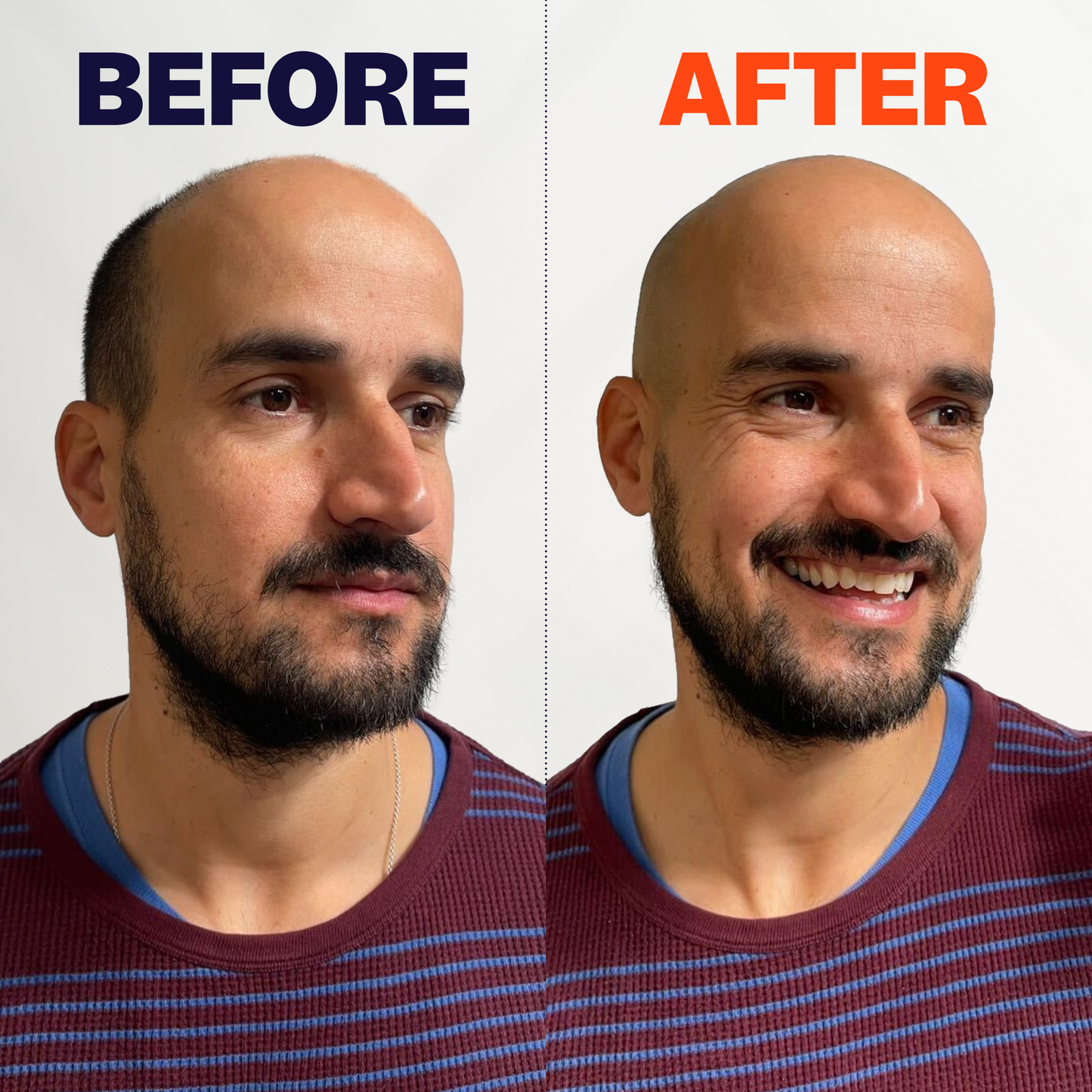 The Electric Scalp Shaver Made for Fast, Easy Head Shaves