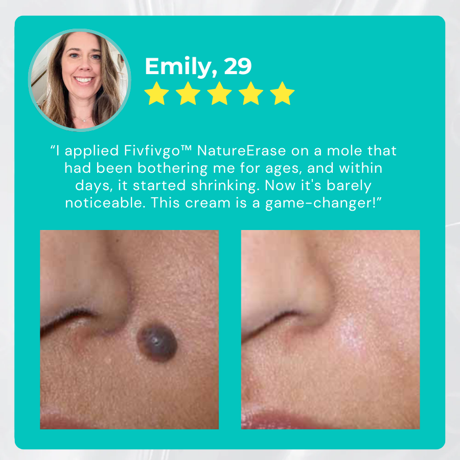 ✅ Official Store: Fivfivgo™ NatureErase Instant Mole & Spot Cream