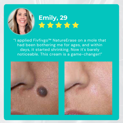 ✅ Official Store: Fivfivgo™ NatureErase Instant Mole & Spot Cream