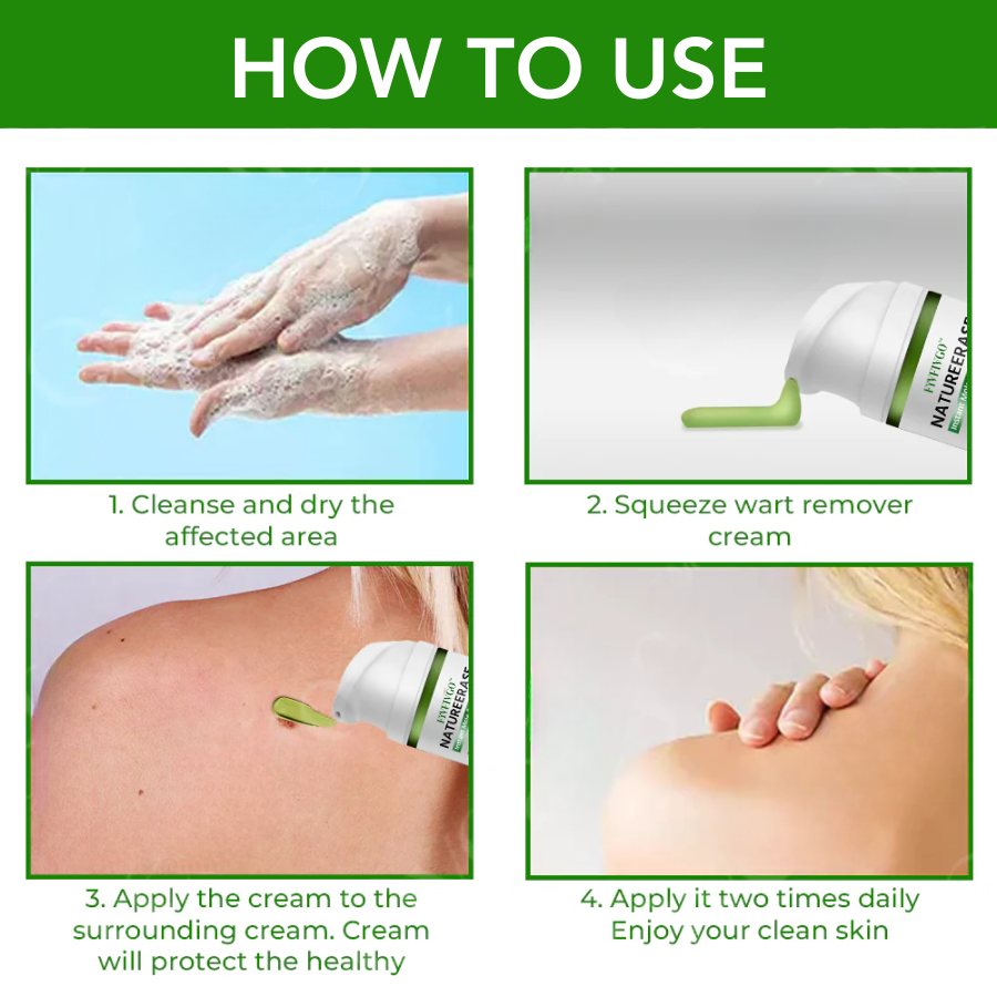 ✅ Official Store: Fivfivgo™ NatureErase Instant Mole & Spot Cream