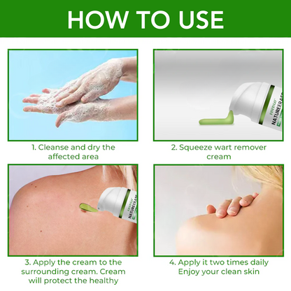 ✅ Official Store: Fivfivgo™ NatureErase Instant Mole & Spot Cream