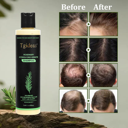 Tgideas® Rosemary Shampoo | Hair Growth & Scalp Treatment