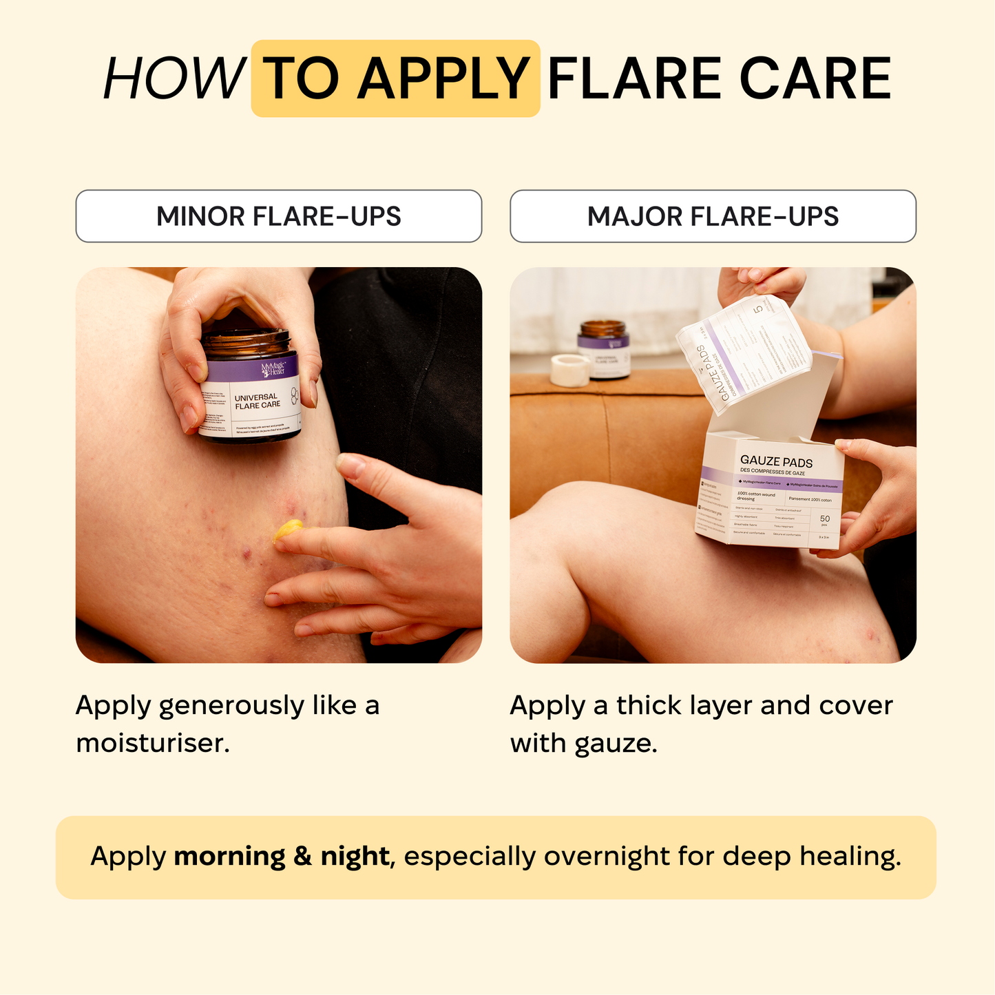 Universal Flare Care Calmer Skin in 7 Days for Boils, HS, Cysts & Painful Flare-Ups