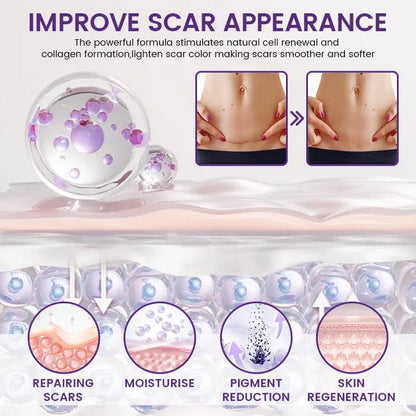 Timilk® ReGenScar Stem Cell Scar Gel - Advanced Skin Repair Formula for Acne, Stretch Marks & Surgical Scars | Fast Healing & Smooth Skin Care