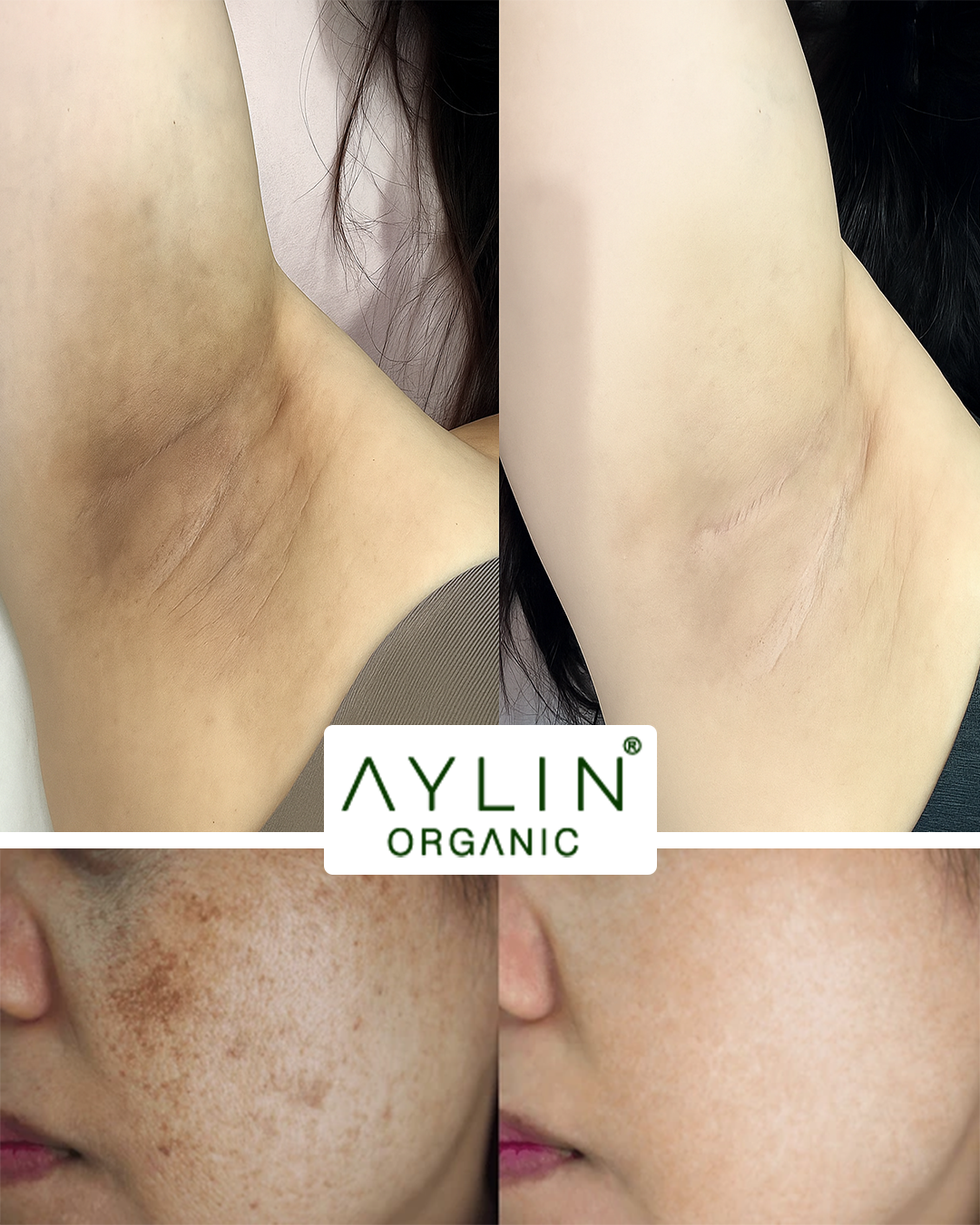 Aylin Organic Full Body Brightening Cream with Pineapple Extract - 100mle